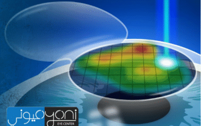 تكلفة عملية الفيمتو ليزك في مصر