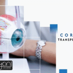 Corneal Transplant (Full / Partial)