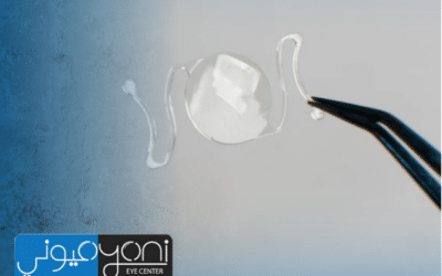أسعار العدسات متعددة البؤر في مصر: دليل المريض لاختيار العدسة الأنسب