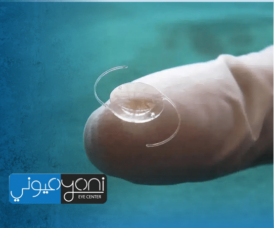 افضل عدسات المياه البيضاء: دليلك للاختيار بناءً على احتياجك