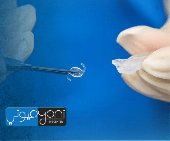 العدسة الذكية للعين — الدليل الأوسع لاختيارٍ يُغيّر يومك مع مركز عيوني بإشراف الدكتور طارق عبد السميع