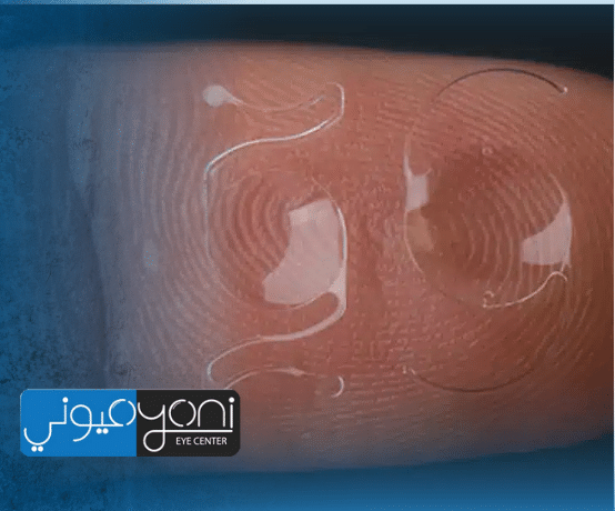 زراعة العدسات متعددة البؤر في مصر: الحل المثالي للاستغناء عن النظارة بعد المياه البيضاء