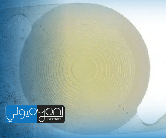 عدسة ثلاثية البؤرة: رؤية واضحة للبعيد والقريب والمتوسط بدون اعتماد دائم على النظارة