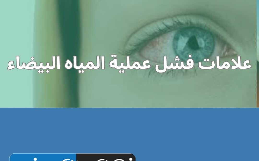 علامات فشل عملية المياه البيضاء