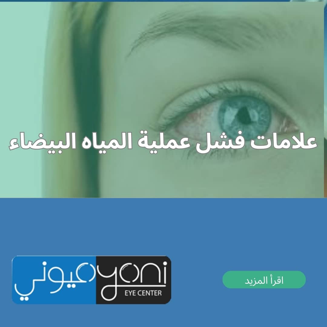 علامات فشل عملية المياه البيضاء