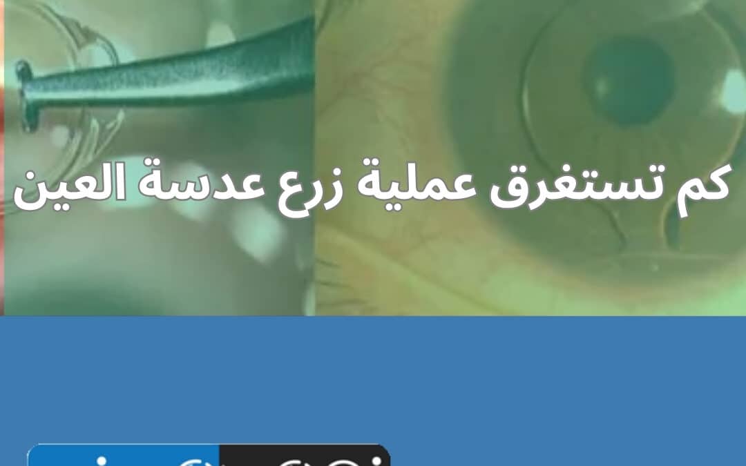 كم تستغرق عملية زرع عدسة العين