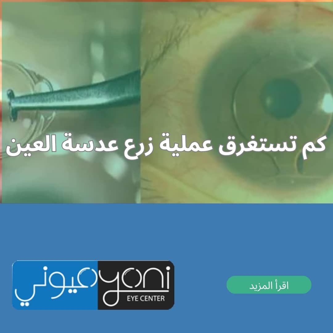 كم تستغرق عملية زرع عدسة العين