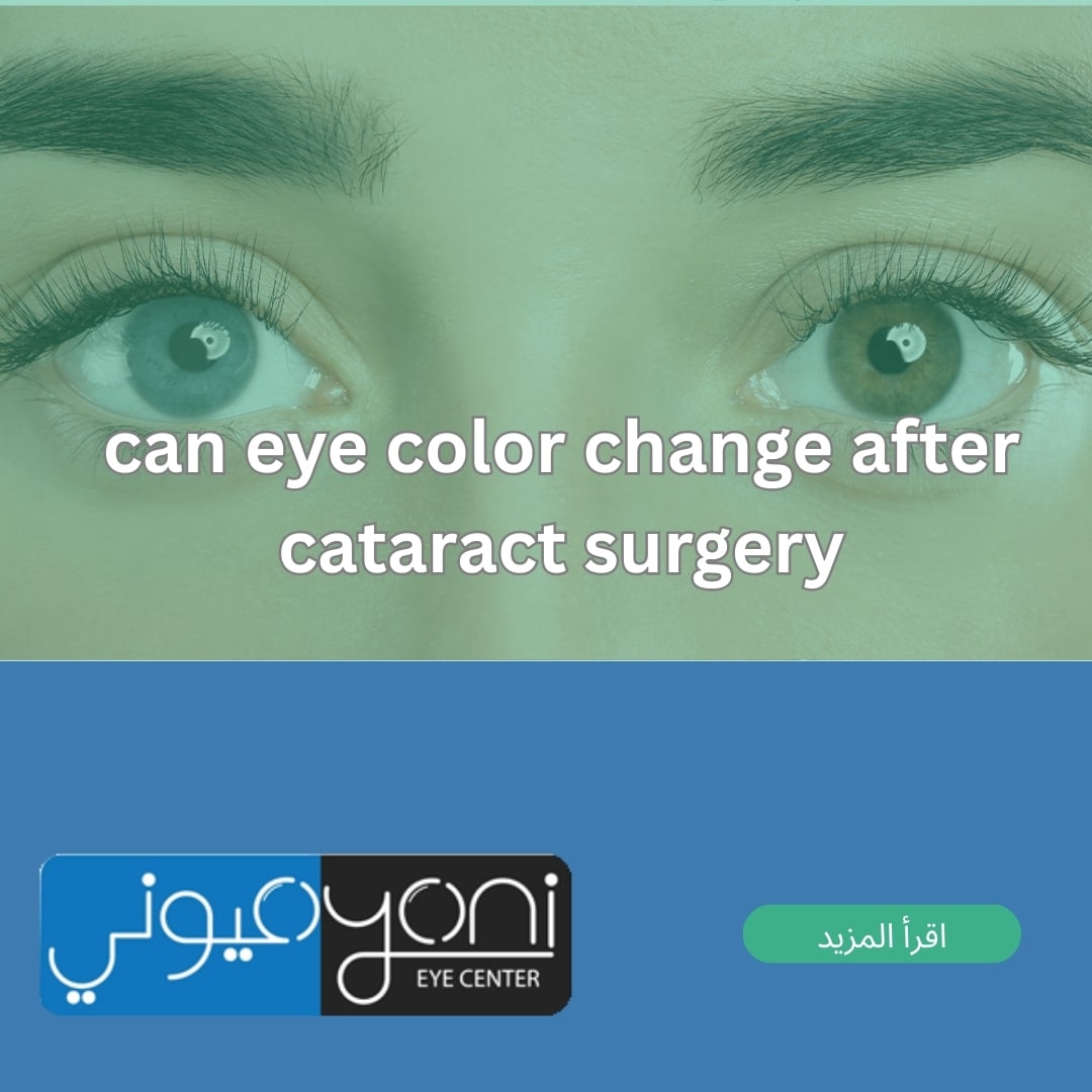 can eye color change after cataract surgery