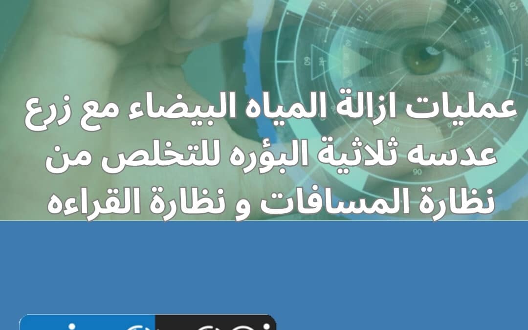 عمليات ازالة المياه البيضاء مع زرع عدسه ثلاثية البؤره للتخلص من نظارة المسافات و نظارة القراءه