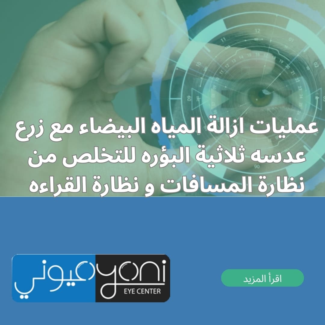 عمليات ازالة المياه البيضاء مع زرع عدسه ثلاثية البؤره