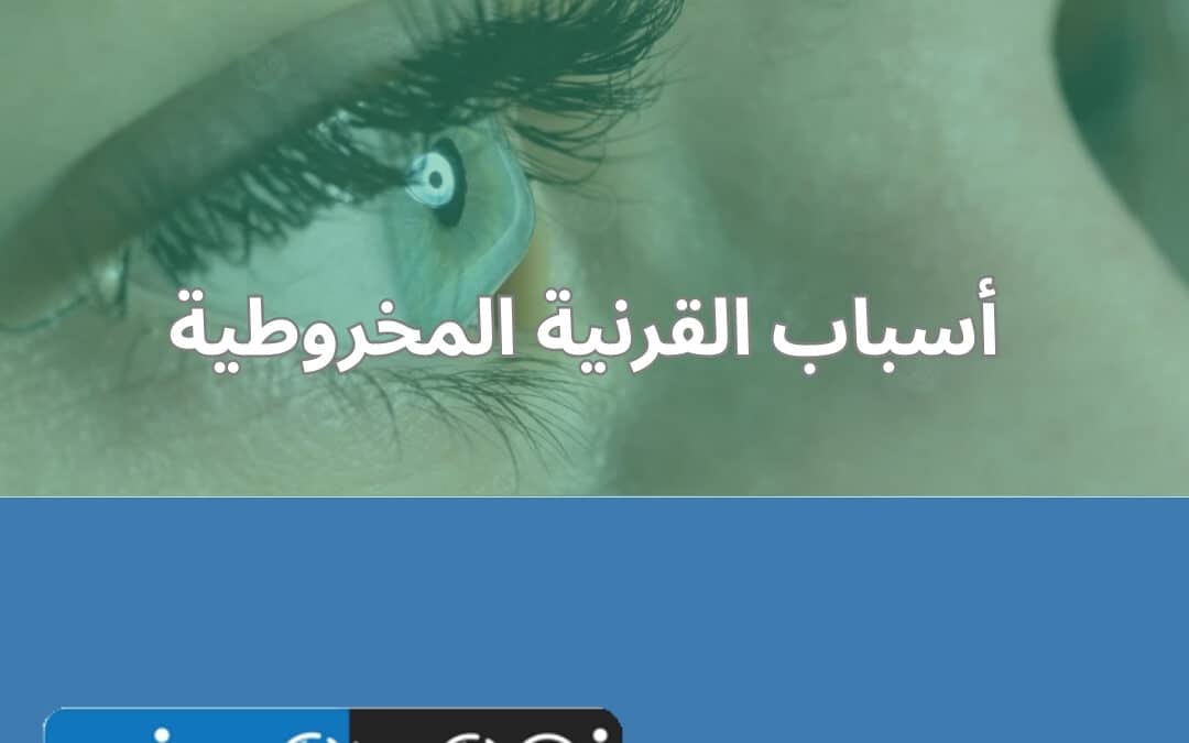 أسباب القرنية المخروطية