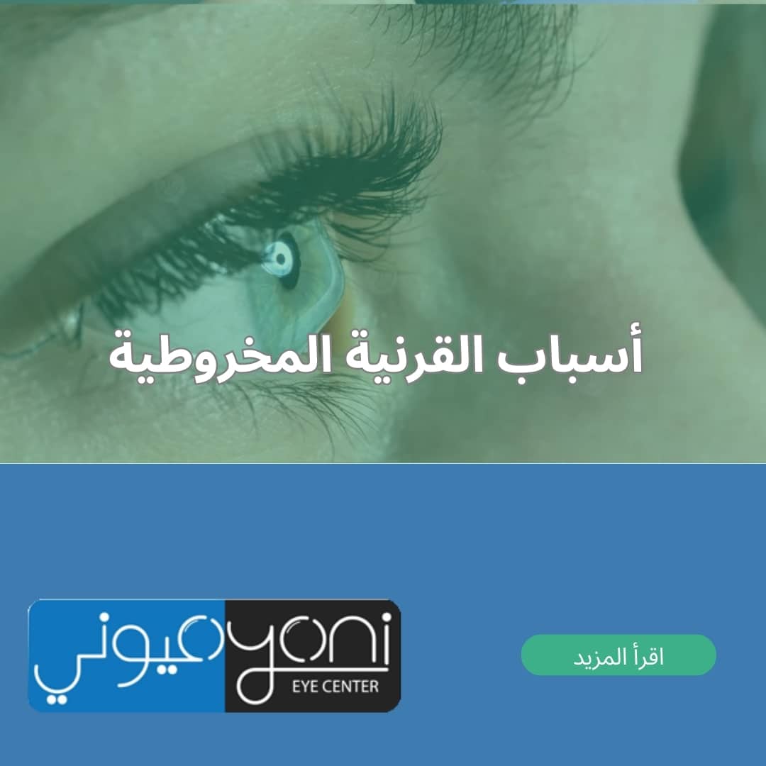 أسباب القرنية المخروطية