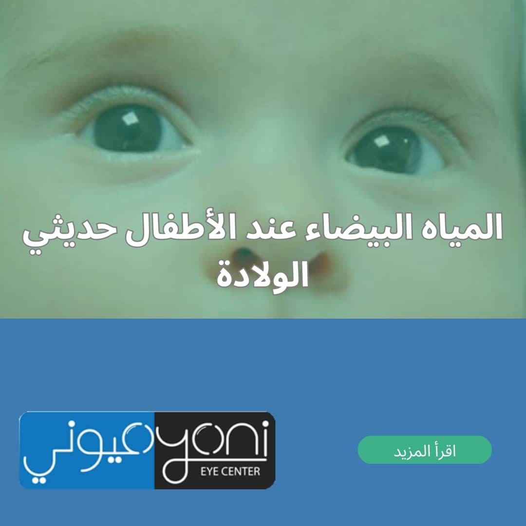 المياه البيضاء عند الأطفال حديثي الولادة