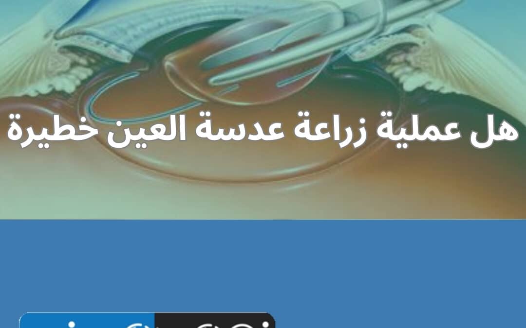 هل عملية زراعة عدسة العين خطيرة