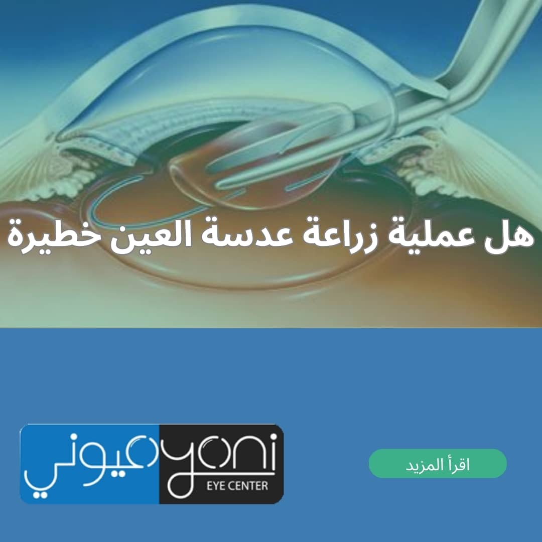 هل عملية زراعة عدسة العين خطيرة