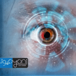 مسح العدسة بالليزر بعد عملية المياه البيضاء