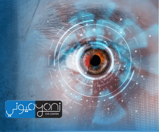مسح العدسة بالليزر بعد عملية المياه البيضاء: متى نحتاجه؟ وكيف يعيد وضوح الرؤية من جديد؟