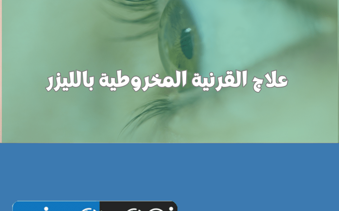 علاج القرنية المخروطية بالليزر