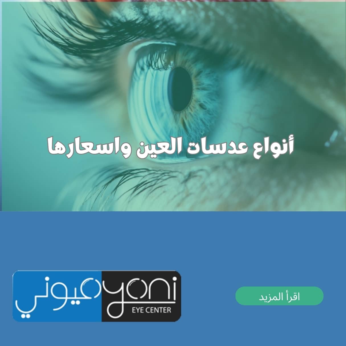 أنواع عدسات العين