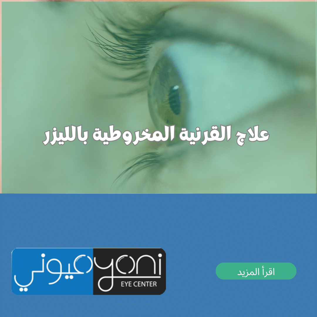 علاج القرنية المخروطية بالليزر