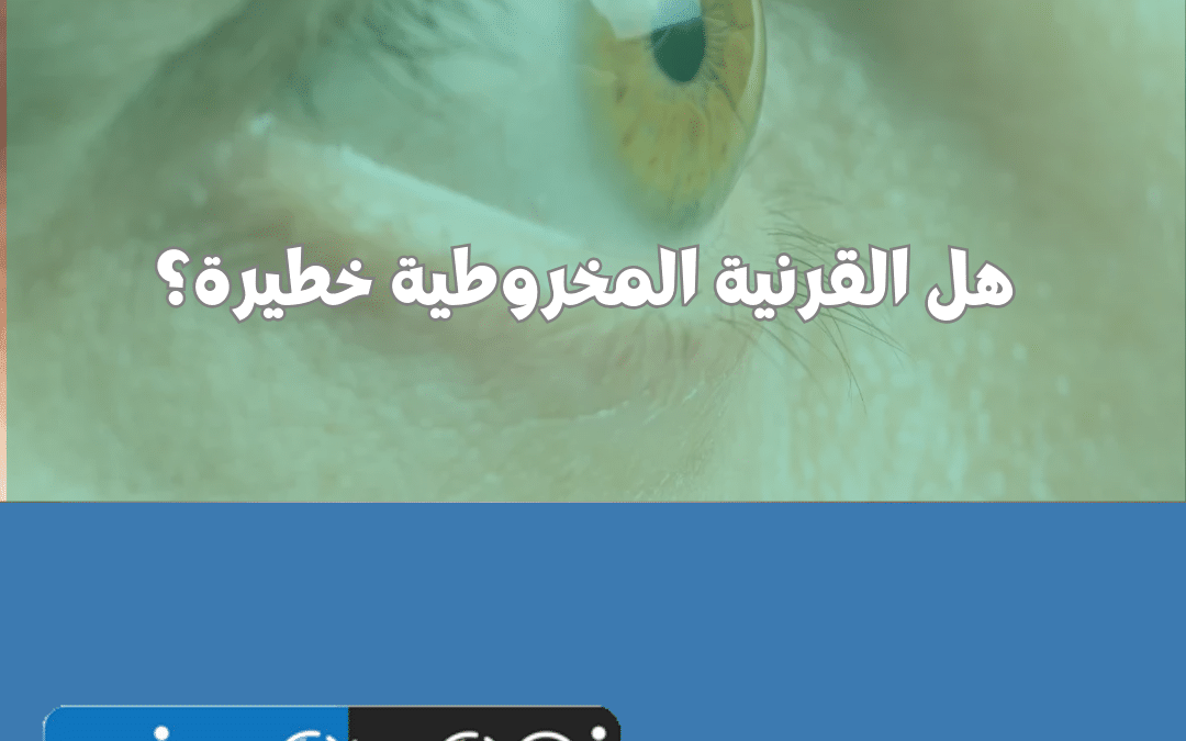 هل القرنية المخروطية خطيرة