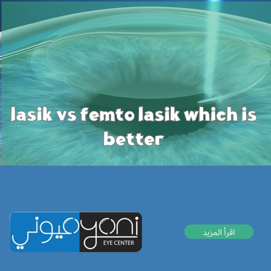 lasik vs femto lasik which is better