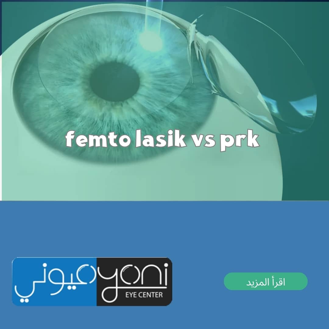 femto lasik vs prk