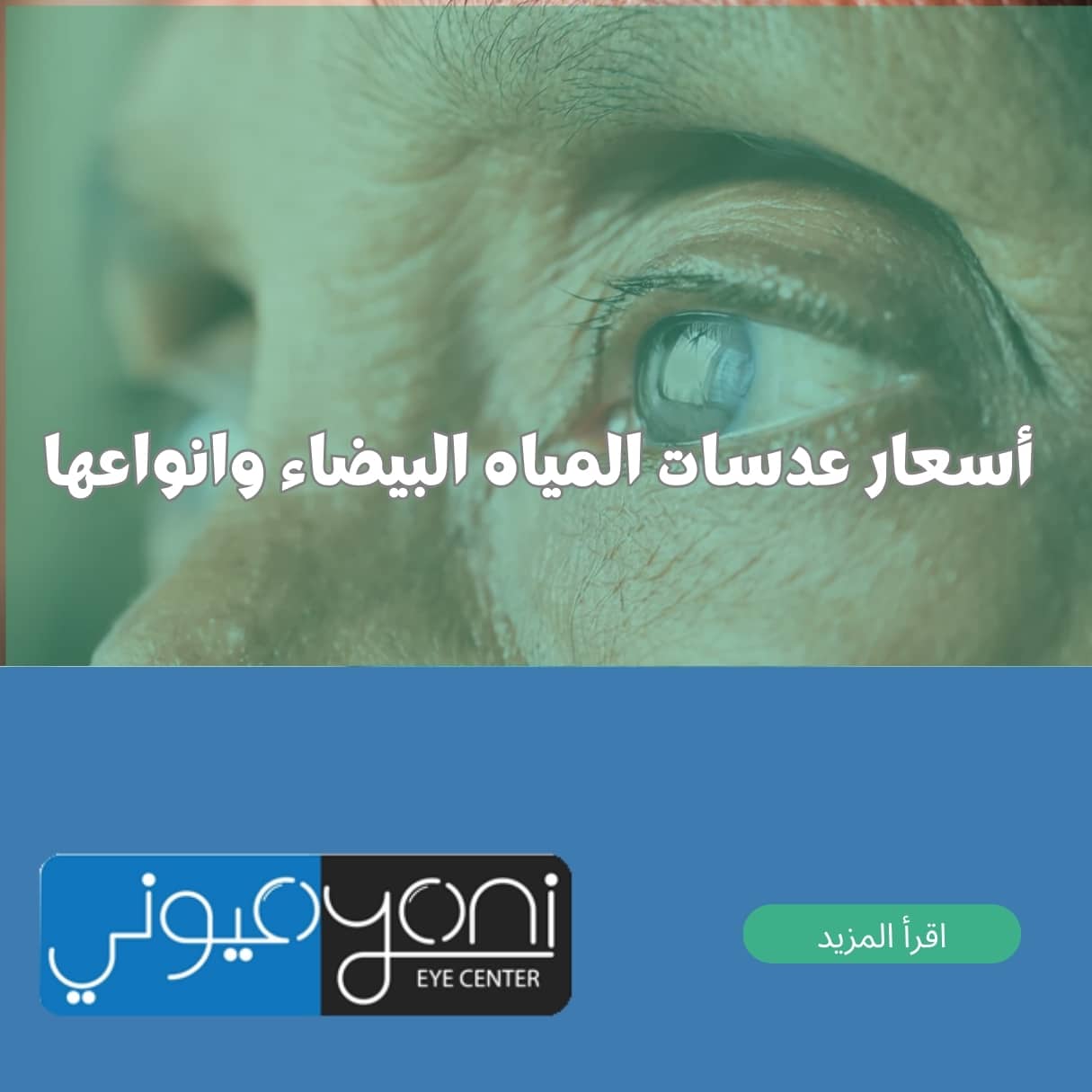 أسعار عدسات المياه البيضاء
