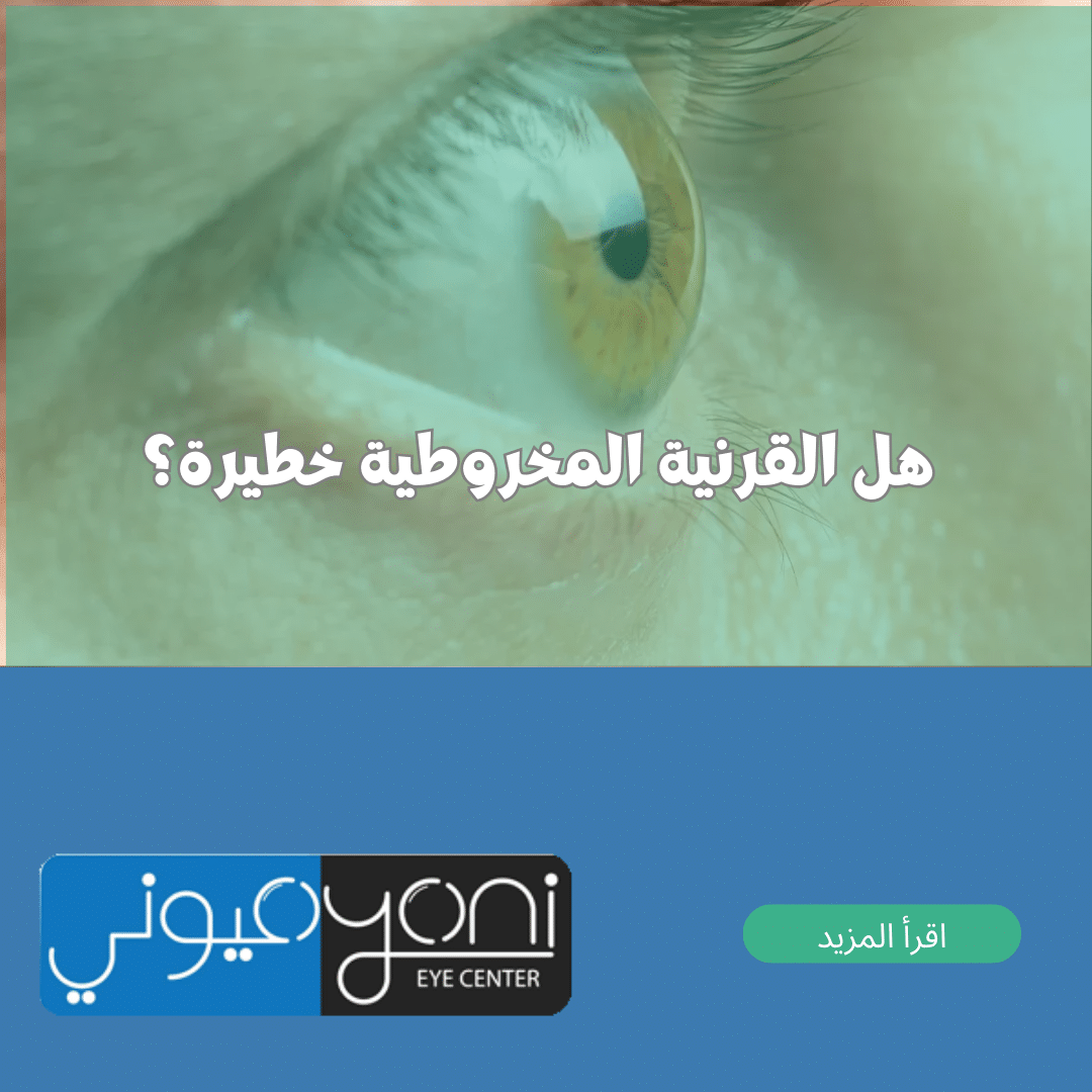 هل القرنية المخروطية خطيرة
