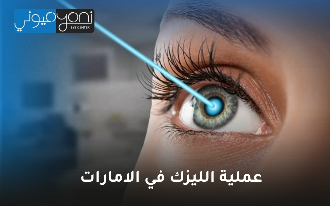عملية الليزك في الامارات عملية الليزك في الامارات