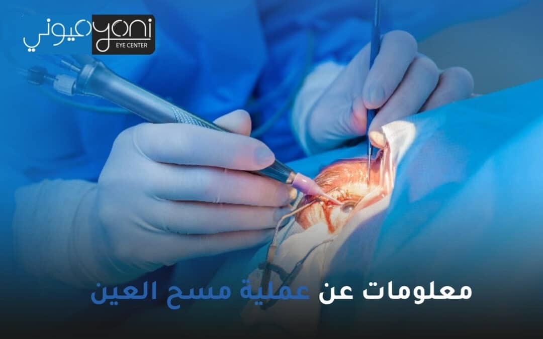 معلومات عن عملية مسح العين