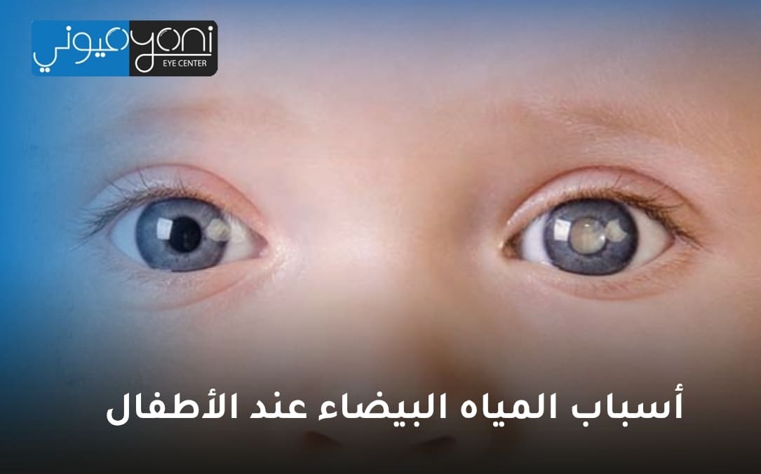 أسباب المياه البيضاء عند الأطفال