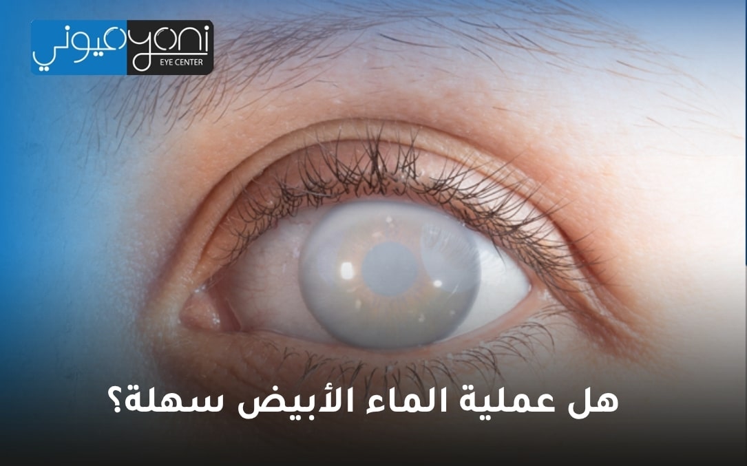 هل عملية الماء الأبيض سهلة