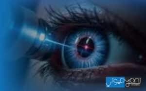اضرار مسح عدسة العين بالليزر