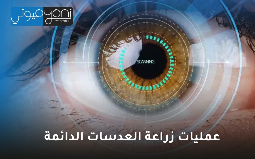 عمليات زراعة العدسات الدائمة عمليات زراعة العدسات الدائمة