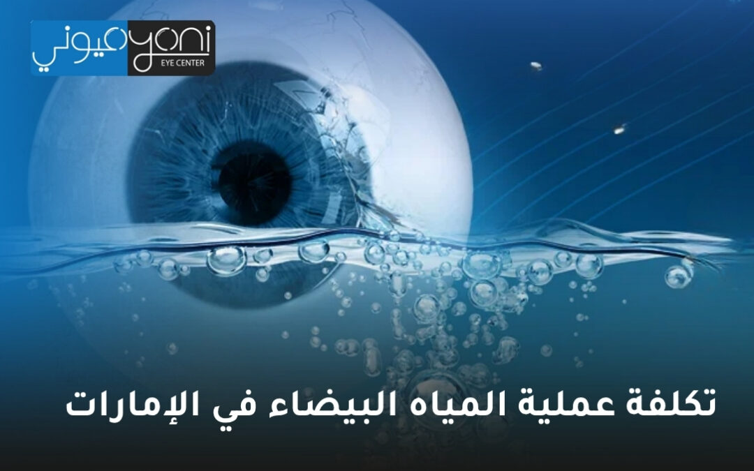 تكلفة عملية المياه البيضاء في الإمارات: دليل شامل لمركز عيوني للعيون