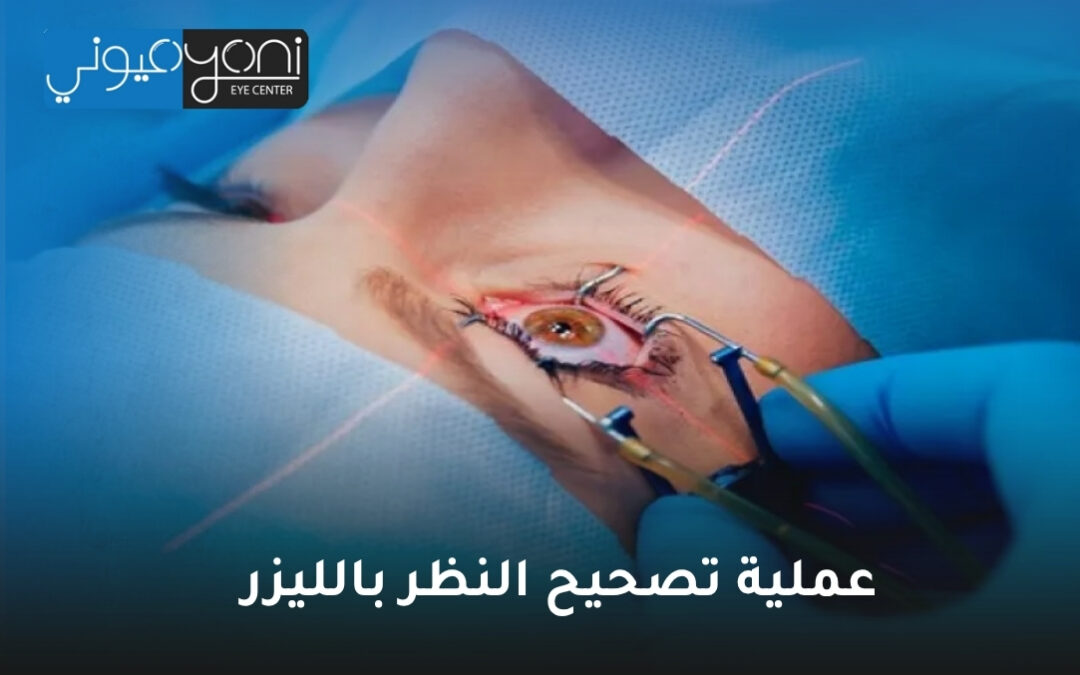 عملية تصحيح النظر بالليزر: دليلك الشامل لاستعادة وضوح الرؤية