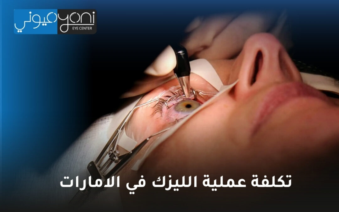 تكلفة عملية الليزك في الامارات: دليلك الشامل لقرار مستنير