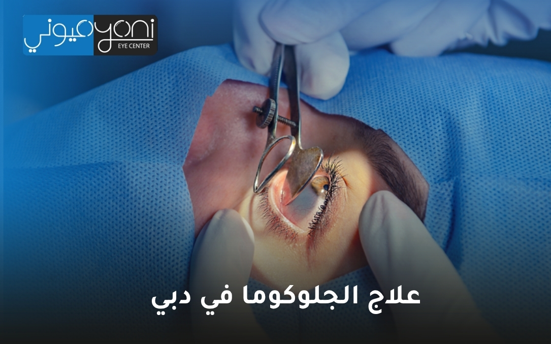 علاج الجلوكوما في دبي علاج الجلوكوما في دبي
