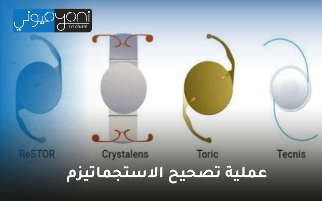 عملية تصحيح الاستجماتيزم: دليل شامل لاستعادة وضوح الرؤية