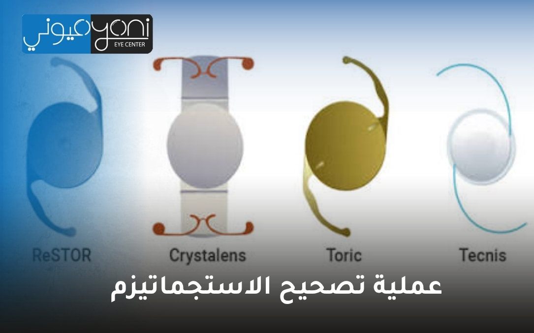 عملية تصحيح الاستجماتيزم عملية تصحيح الاستجماتيزم