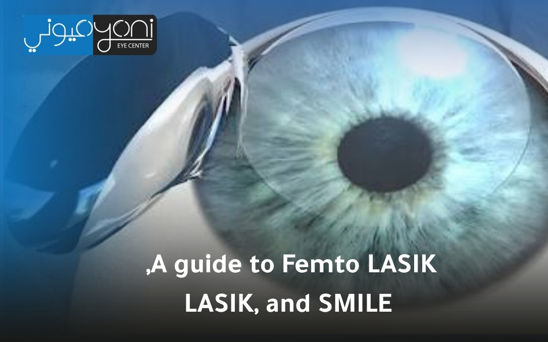 Femto LASIK LASIK and SMILE Femto LASIK LASIK and SMILE