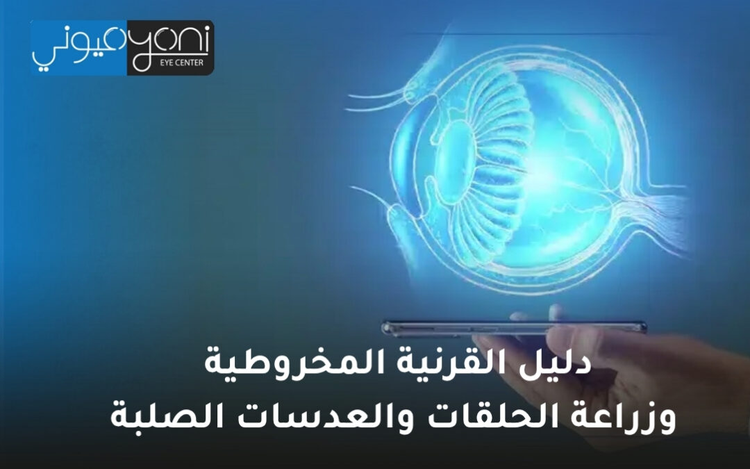 دليل القرنية المخروطية وزراعة الحلقات والعدسات الصلبة