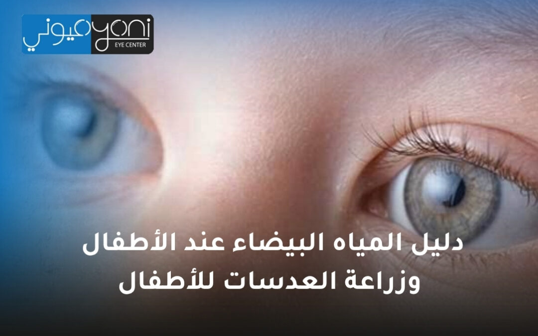 دليل المياه البيضاء عند الأطفال وزراعة العدسات للأطفال