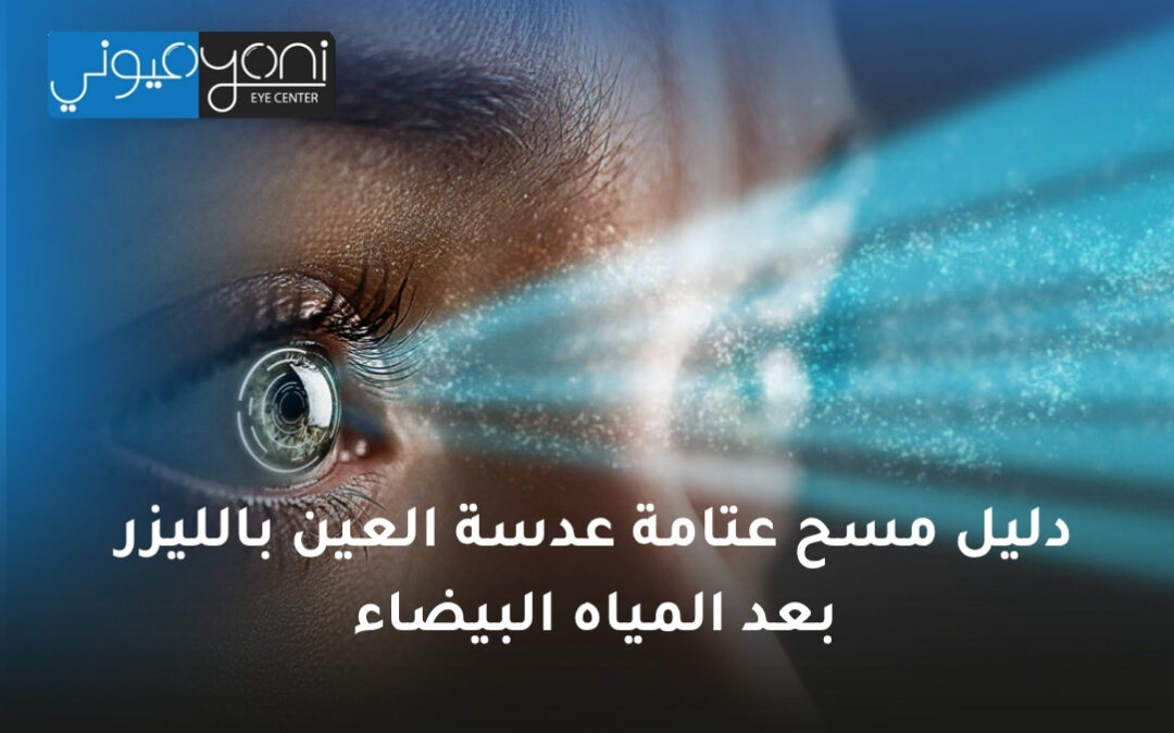 دليل مسح عتامة عدسة العين بالليزر بعد المياه البيضاء