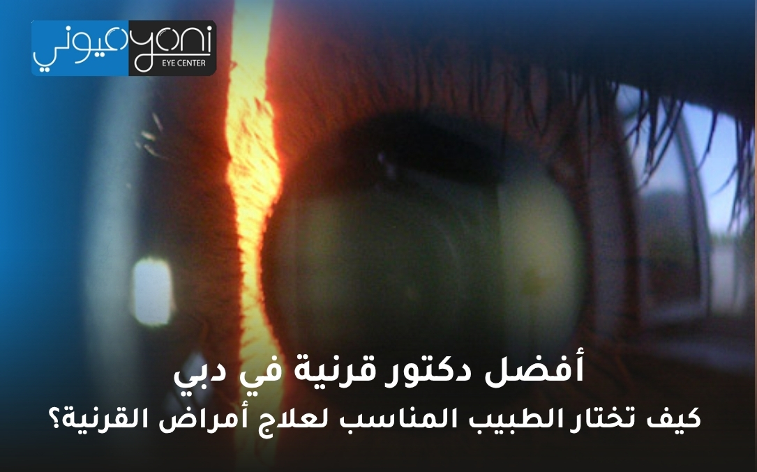 أفضل دكتور قرنية في دبي