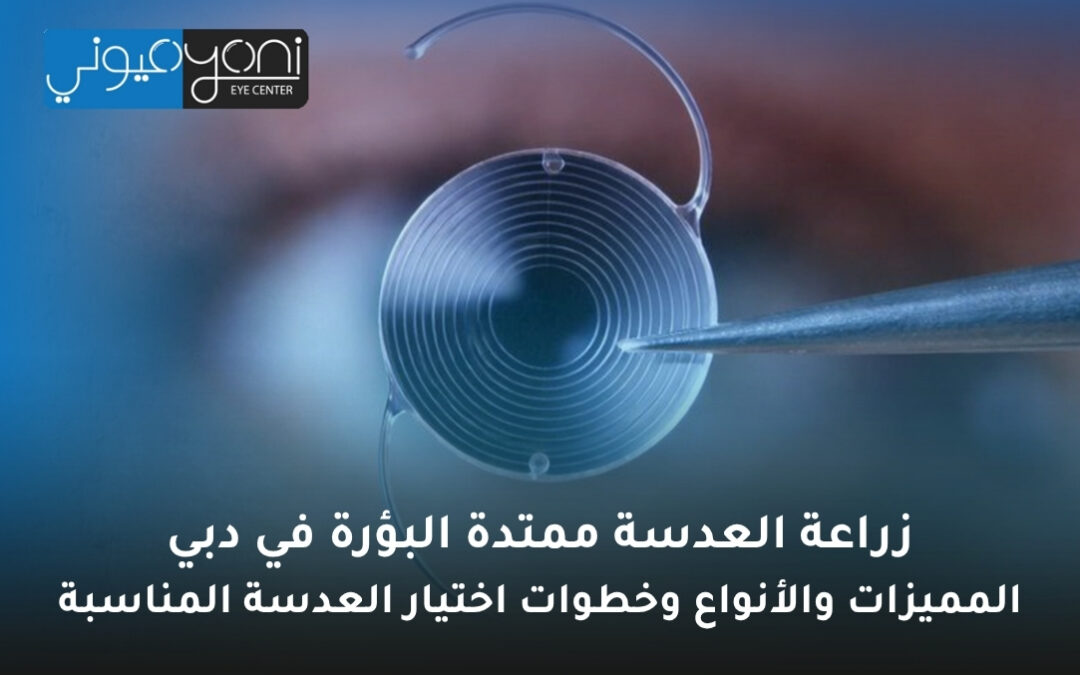 زراعة العدسة ممتدة البؤرة في دبي: المميزات والأنواع وخطوات اختيار العدسة المناسبة