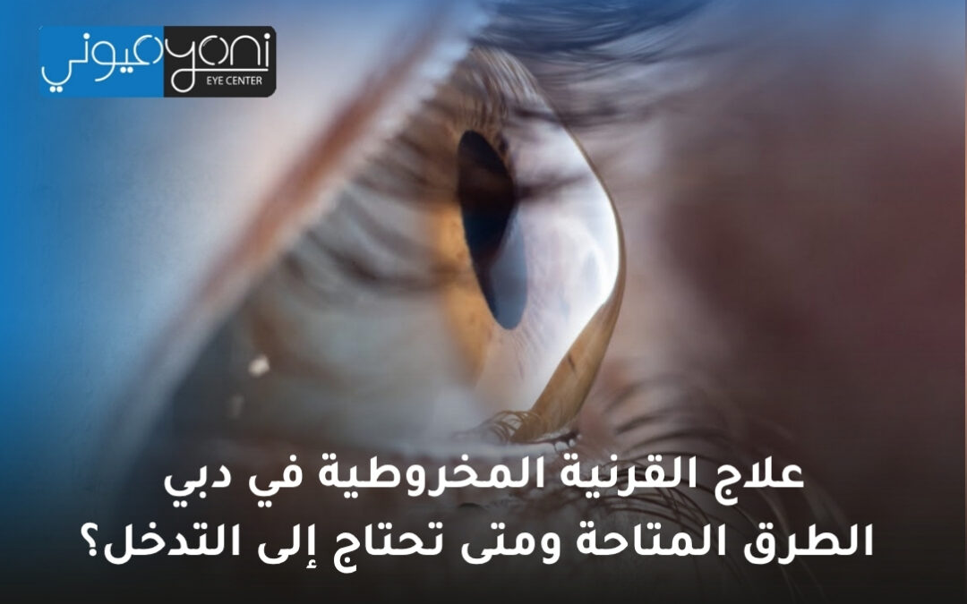 علاج القرنية المخروطية في دبي: الطرق المتاحة ومتى تحتاج إلى التدخل؟