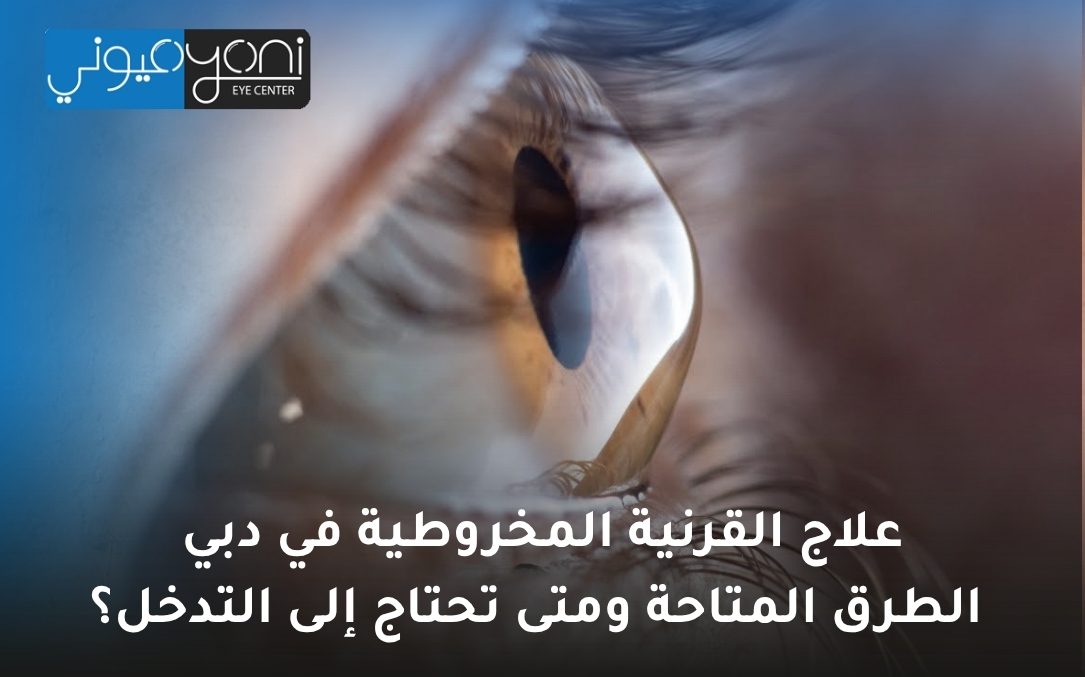 علاج القرنية المخروطية في دبي علاج القرنية المخروطية في دبي