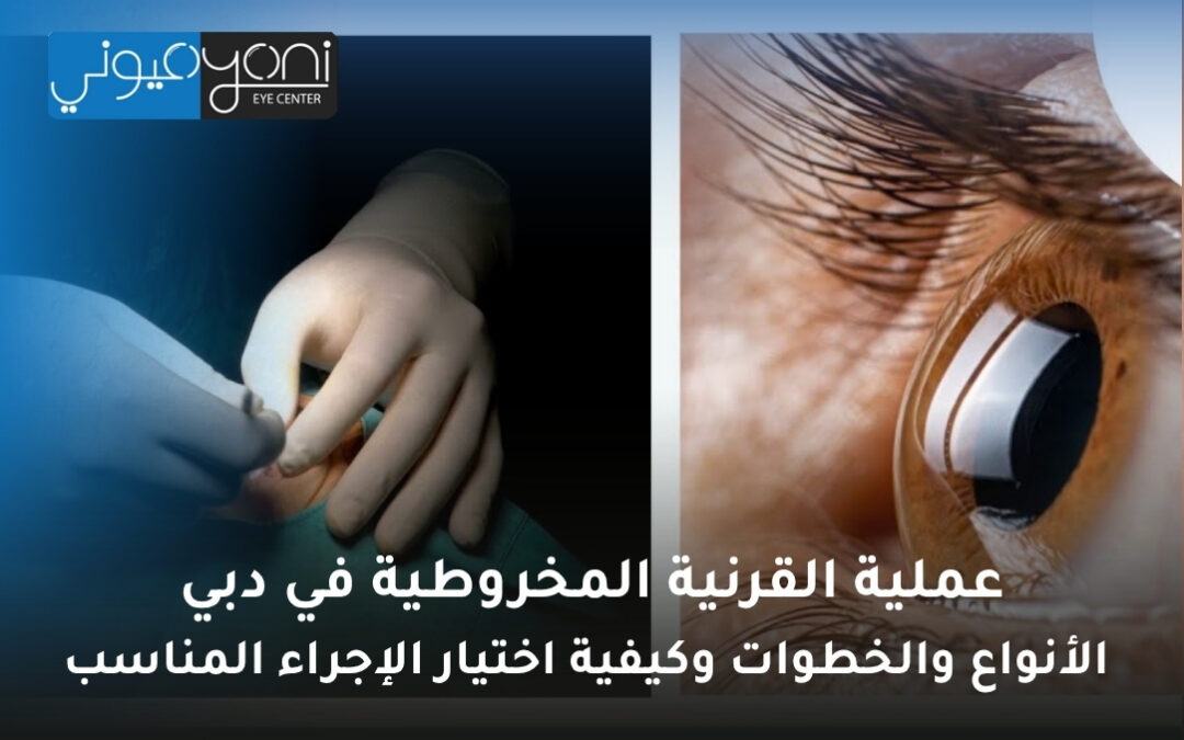 عملية القرنية المخروطية في دبي: الأنواع والخطوات وكيفية اختيار الإجراء المناسب
